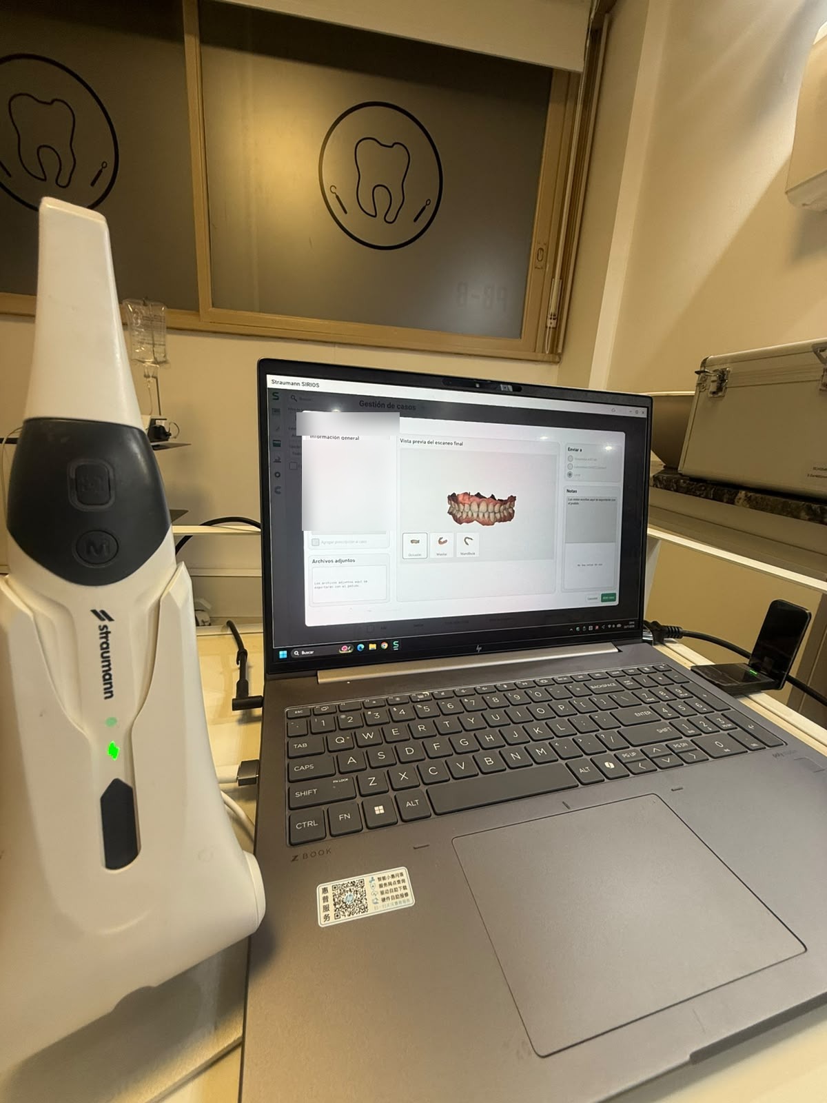 Escáner intraoral